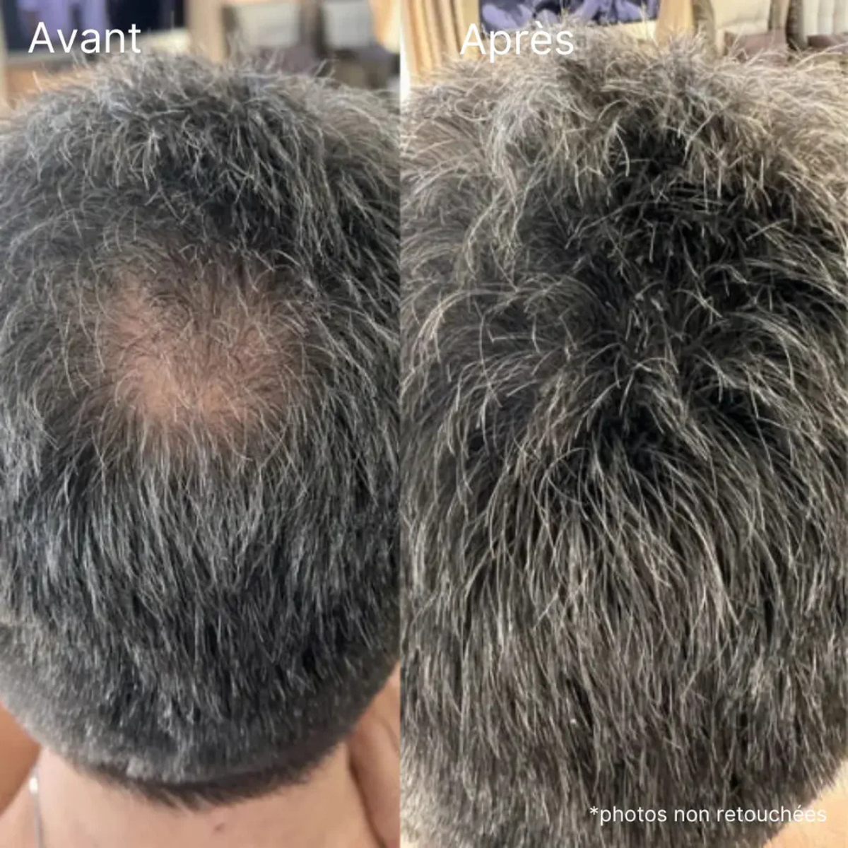 PalmHair® – Crème capillaire densifiante, effet immédiat